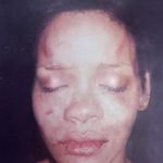 Rihanna battered face