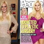 heidi-montag-before-and-after